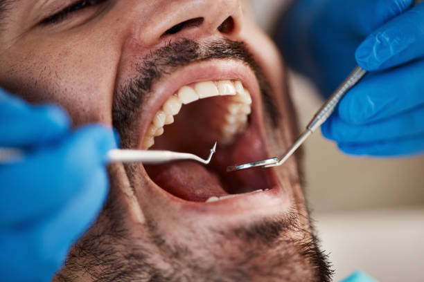 Best Emergency Gum Treatment in Savoy, IL