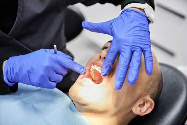Best Urgent Care for Lost Fillings or Crowns in Savoy, IL